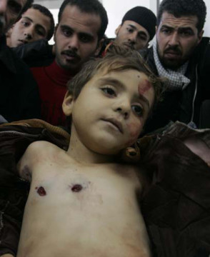 Shot Gazan Child